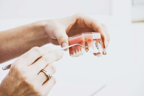geriausiu dantu implantu